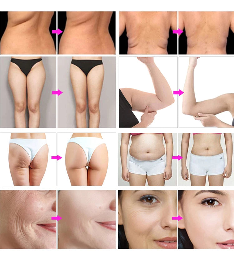 Body Slimming Machine  | Professional Beauty Salon Equipment