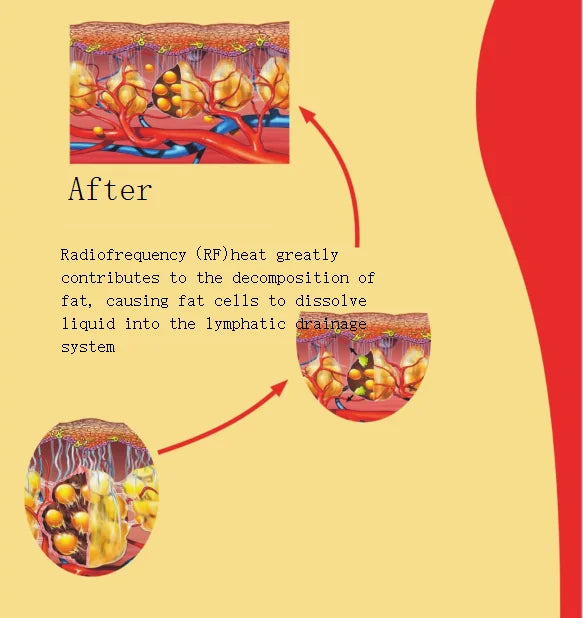 Aesthetics Ultra 360 Slimming  Machine