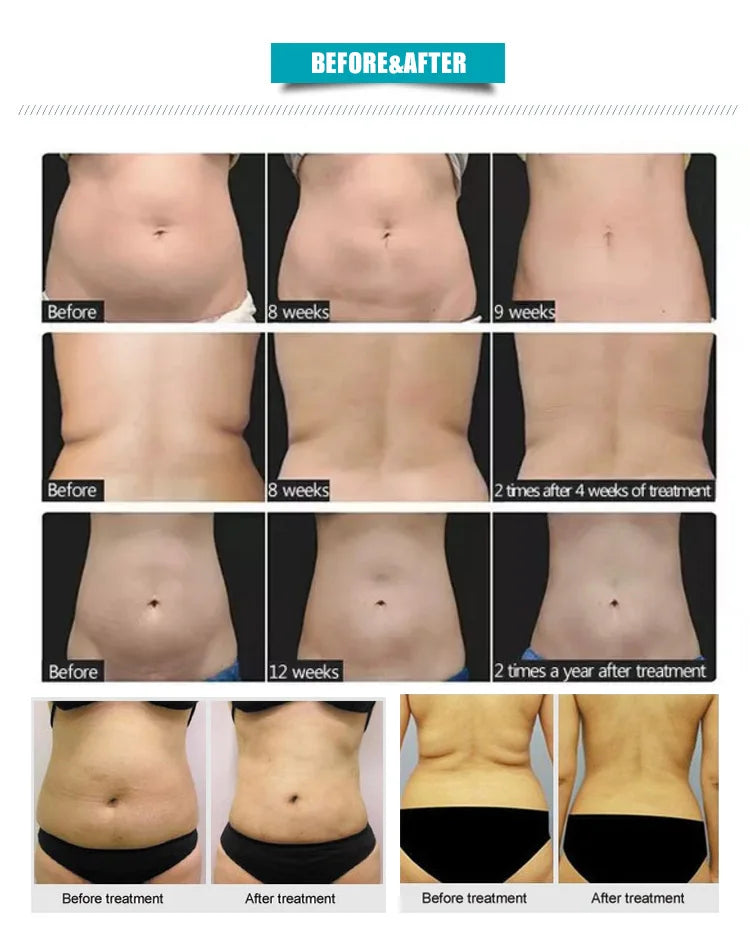 Aesthetics Ultra 360 Slimming  Machine